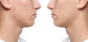 before and after 1 (2)