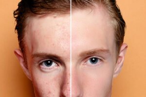 before and after 4 (2)